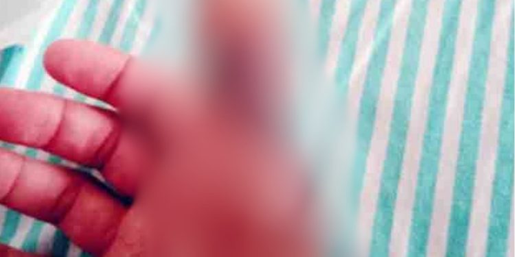 Paciente espera há quatro meses por cirurgia de dedo em Porto Velho