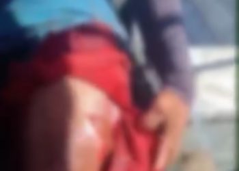 MORADOR DE CALAMA É FERIDO POR JACARÉ ENQUANTO PESCAVA