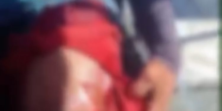 MORADOR DE CALAMA É FERIDO POR JACARÉ ENQUANTO PESCAVA