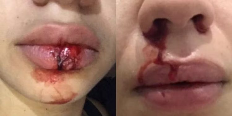 Secretário municipal de Costa Marques é indiciado por violência doméstica