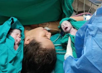 Jovem de Jaru dá à luz trigêmeas idênticas após gravidez considerada rara em Rondônia