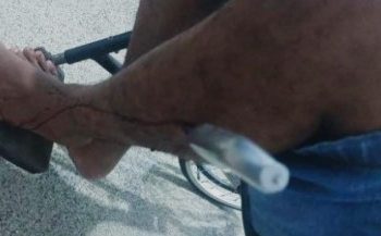 Adolescente de 15 anos esfaqueia marido após festa em Porto Velho