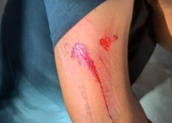 Menor provoca acidente e foge sem prestar socorro em RO