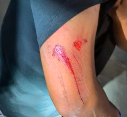 Menor provoca acidente e foge sem prestar socorro em RO