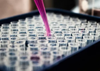 Pesquisadores apontam que inflamação pode ser peça central no avanço do Alzheimer