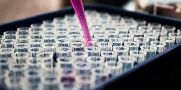 Pesquisadores apontam que inflamação pode ser peça central no avanço do Alzheimer