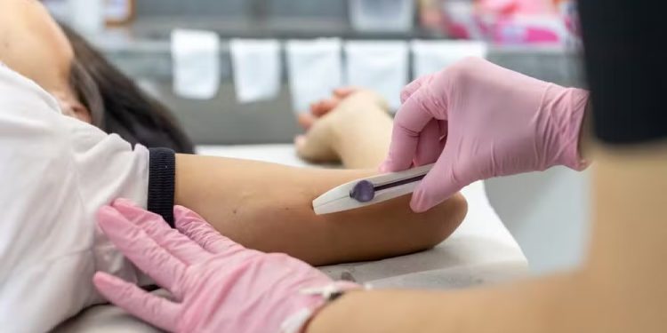 Implanon de graça: Prefeitura de Porto Velho passa a oferecer contraceptivo pelo SUS