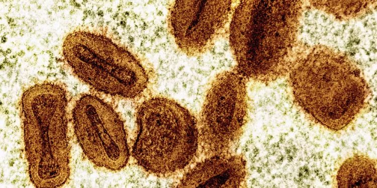 Mpox avança em Rondônia e número de casos chega a oito; criança está entre infectados